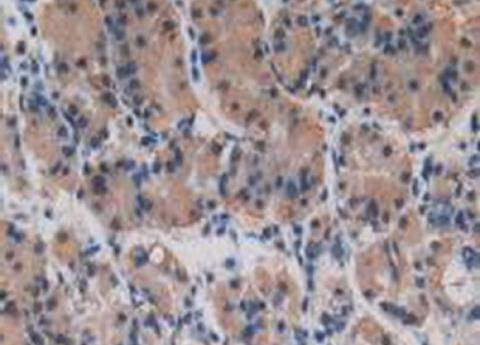 IHC-P analysis of Human Stomach Tissue, with DAB staining.