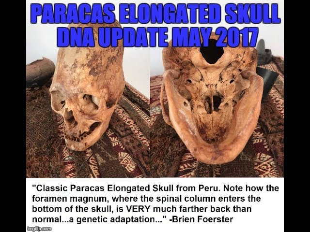 DNA Testing Of Paracas Peru Elongated Skulls: May 2017 Update  Sddefault