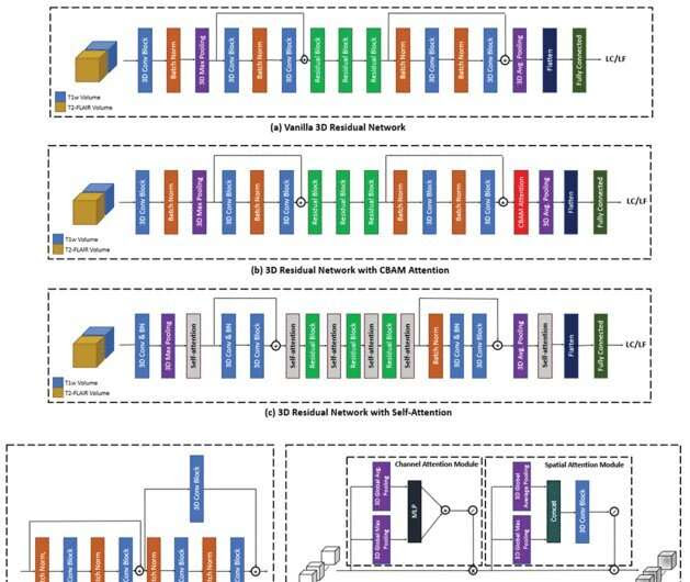 AI better than human eye at predicting brain metastasis outcomes