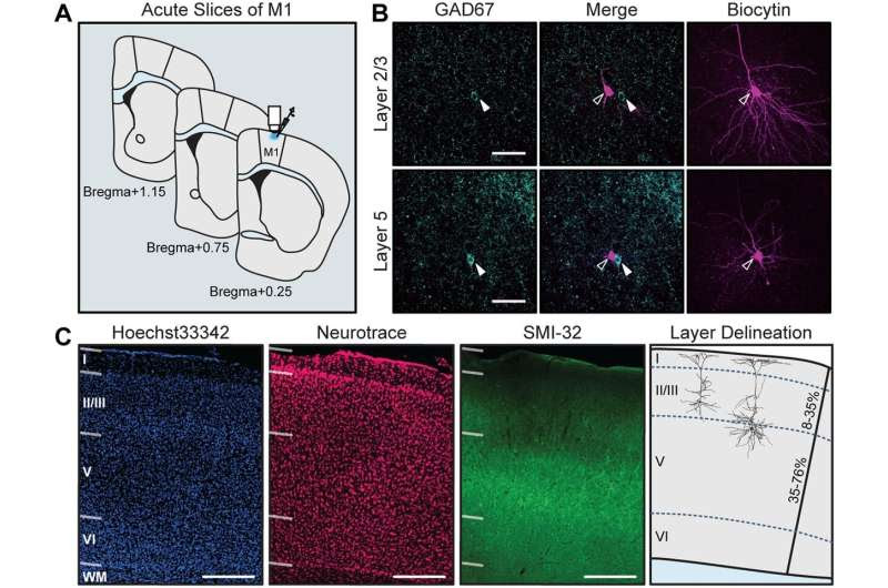 Study reveals motor cortex could have larger role in Parkinson's disease