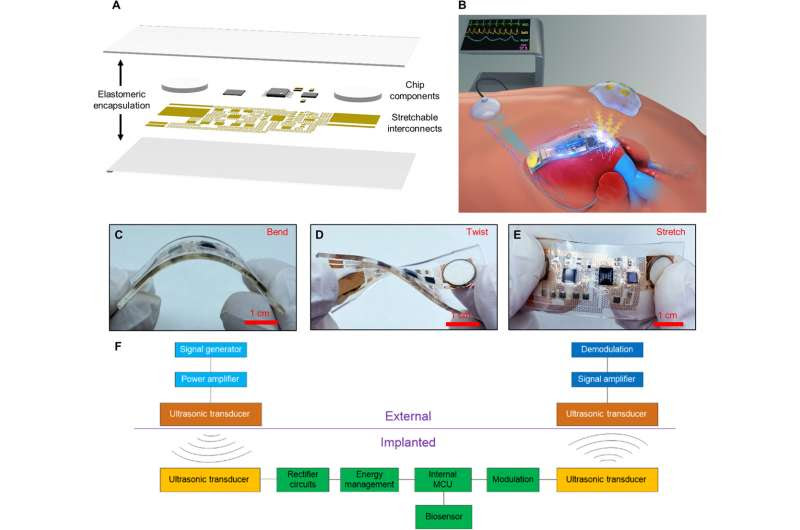 Simultaneous acoustic energy transfer and communication in neuroscience and cardiovascular medicine