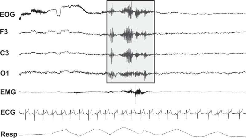 Short on sleep? Your heart may have a harder time adjusting to disruptions during sleep