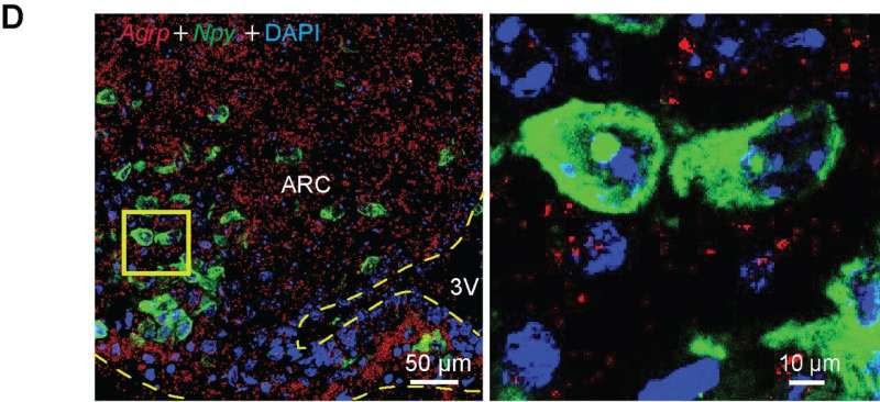 Researchers pinpoint brain cells that drive appetite in obesity