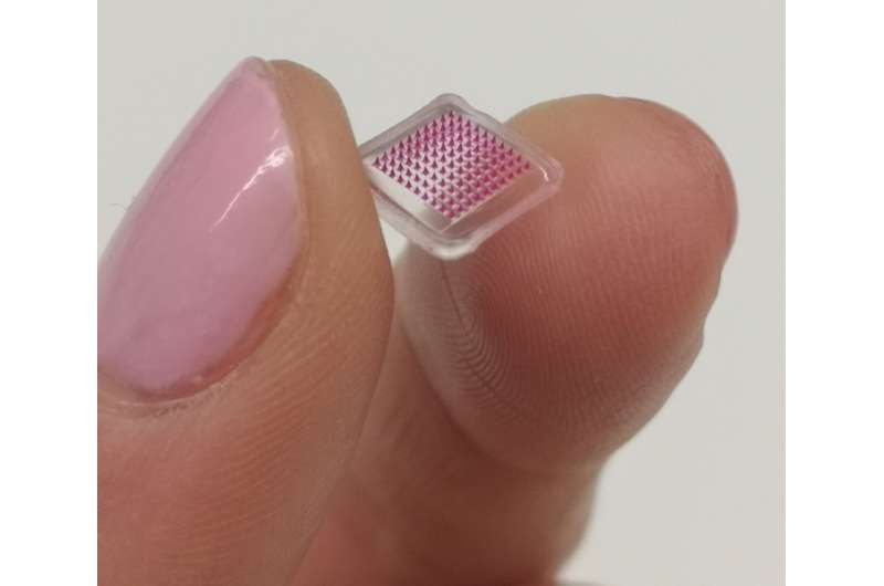 Microneedle patch delivers antibiotics locally in the skin