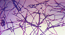 Photo of Anthras spores