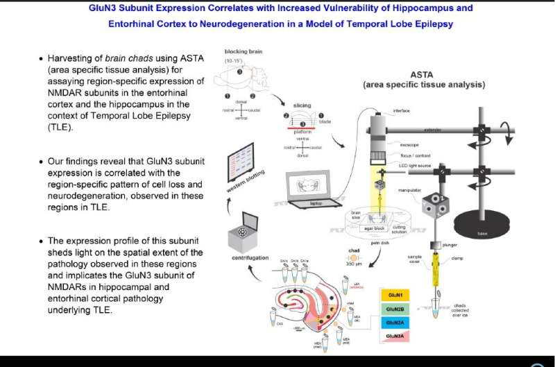Link between specific brain protein and vulnerability to temporal lobe epilepsy neurodegeneration discovered