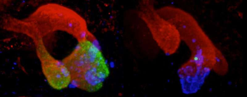 Researchers show how mutations in 'dark genome' cause pancreatic malformations