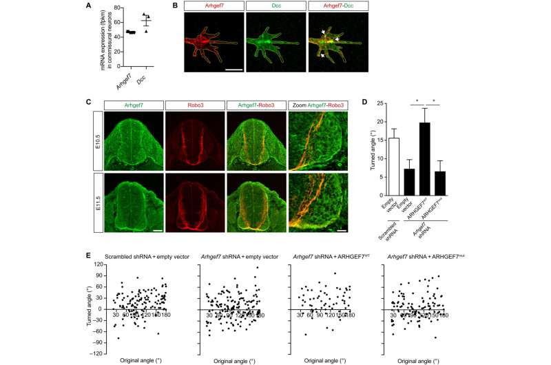 The mutated gene behind mirror movement disorder identified