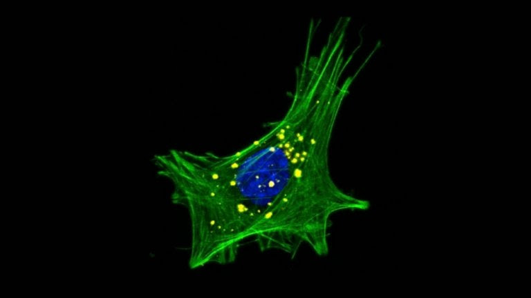 Desequilíbrio de bactérias boas no intestino pode causar doença de Parkinson