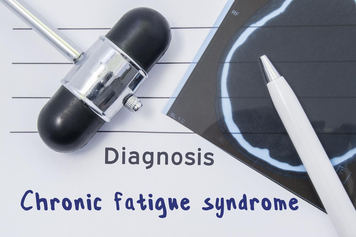 A study found around half of the long COVID patients examined fit the diagnostic criteria for chronic fatigue syndrome