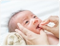 Gingival Cysts in Newborns