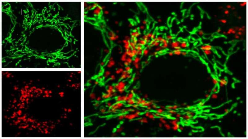 A new method for treating Alzheimer’s disease