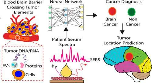 Biosensor detects brain tumors with less than a drop of blood