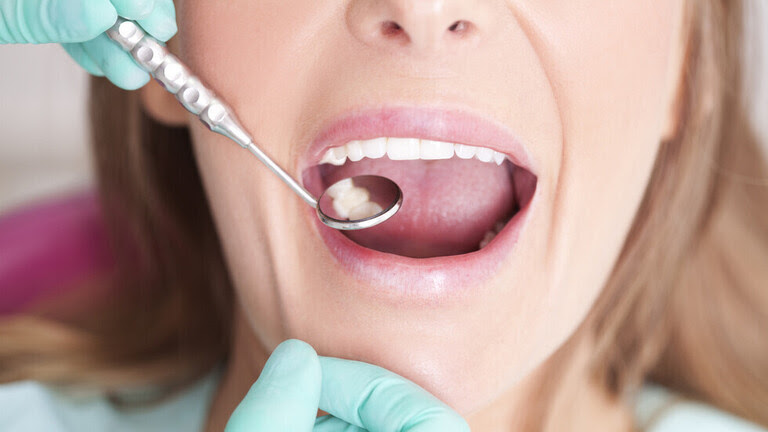 علامات في فمك قد تشير إلى وجود 4 حالات صحية قاتلة