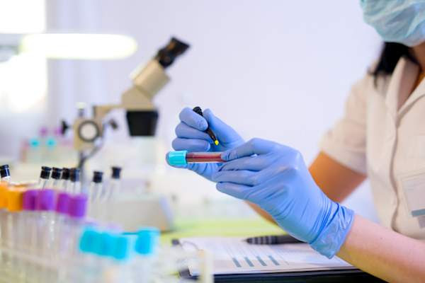 Científico que trabaja en un laboratorio, escribiendo en un tubo de sangre