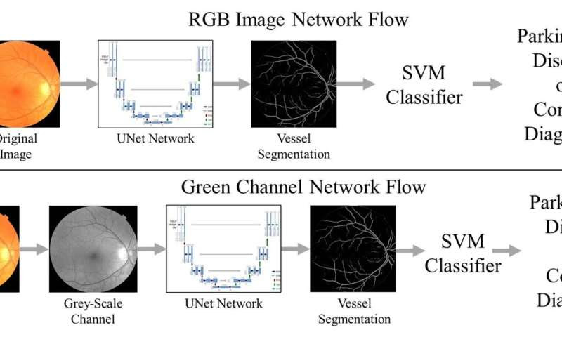 Eye exam could lead to early Parkinson's disease diagnosis