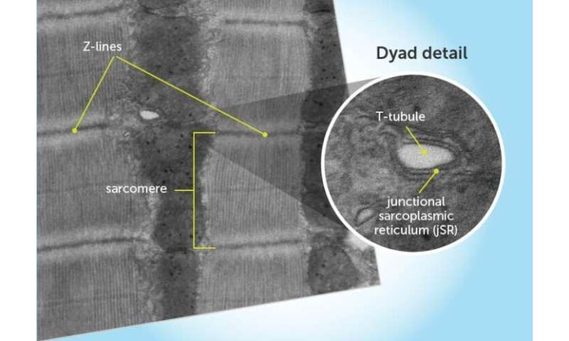 Getting to the heart of heart muscle function