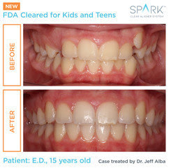 Spark for Kids & Teens II Spark for Kids & Teens II
