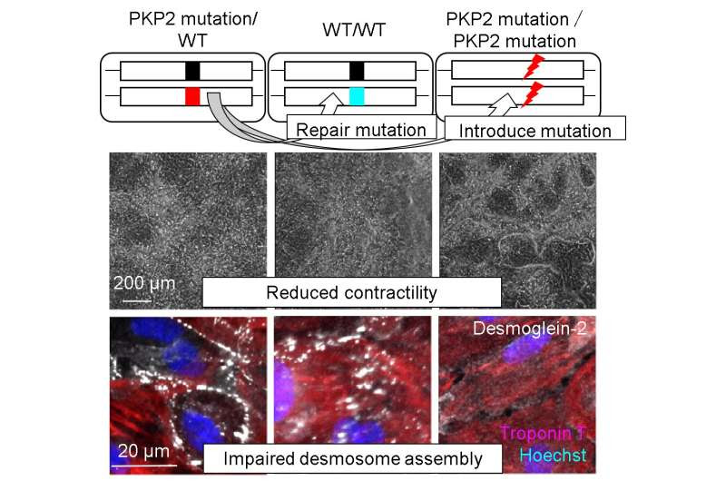 Patient-derived heart cells mimic disease in vitro