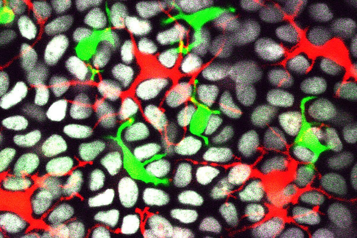 A microscope image of immune cells (Langerhans cells in red, dendritic epidermal T cells in green) spreading out among the epithelial cells in the skin