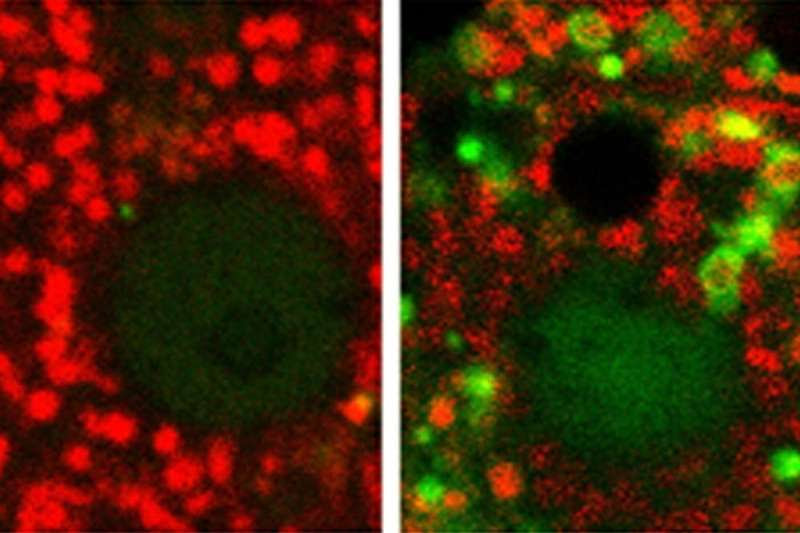 Problems in the powerhouse: Excessive degradation of mitochondria is the tipping point from normal alcohol metabolism to alcohol