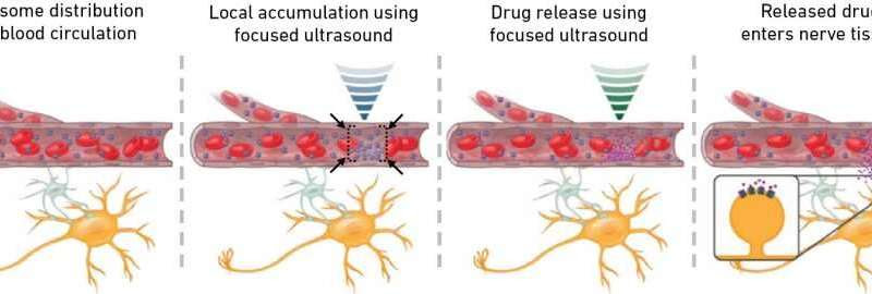 Millimetre-precision drug delivery to the brain