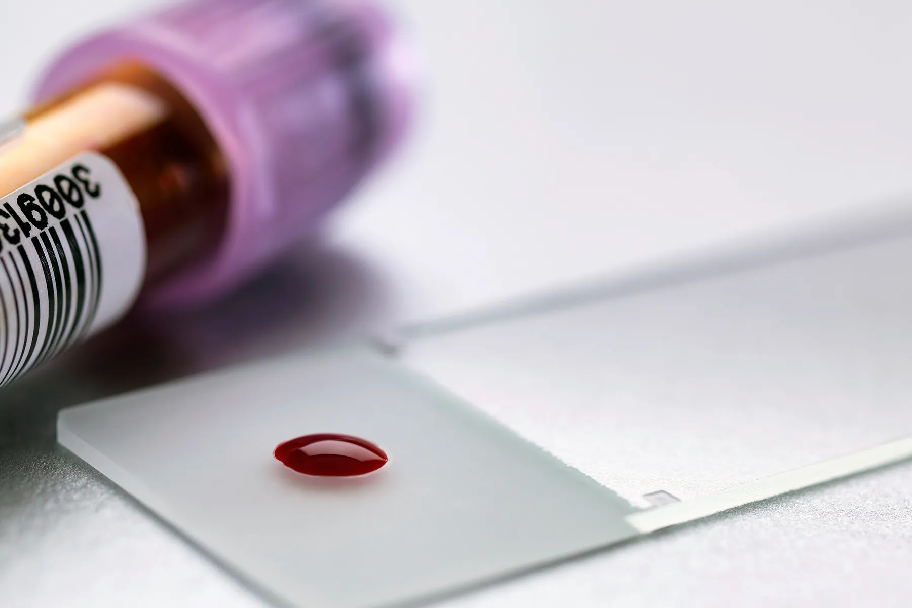 blood sample on slide