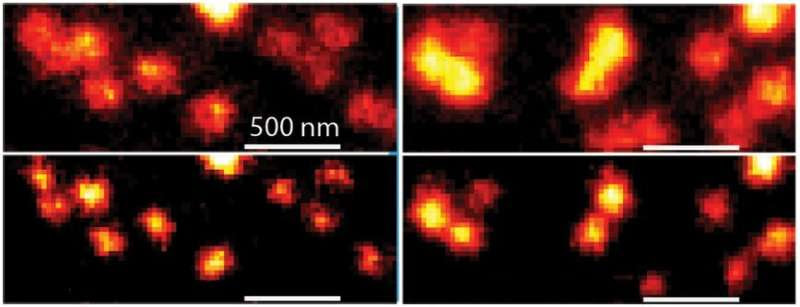 Identifying and attacking the HIV virus' most dangerous parts may now be possible