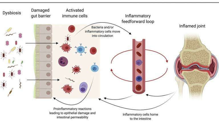 Targeting the gut to relieve rheumatoid arthritis