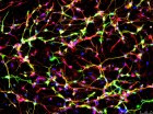 Feng-dopamine-HI Image shows a protein found only in neurons (red) and an enzyme that synthesizes dopamine (green). Cell DNA is labeled in blue. (credit: Jian Feng, University at Buffalo)