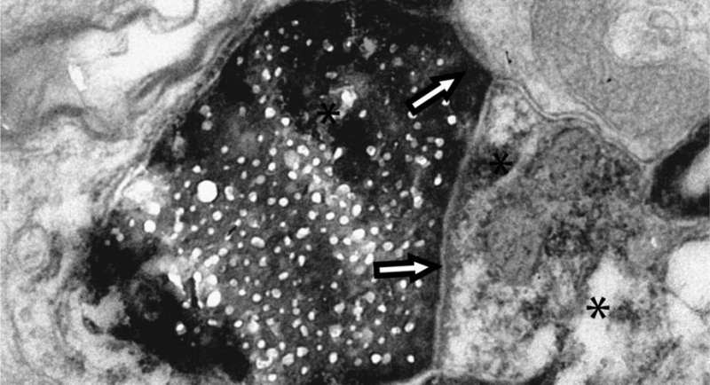 Researchers discover new type of cellular communication in the brain