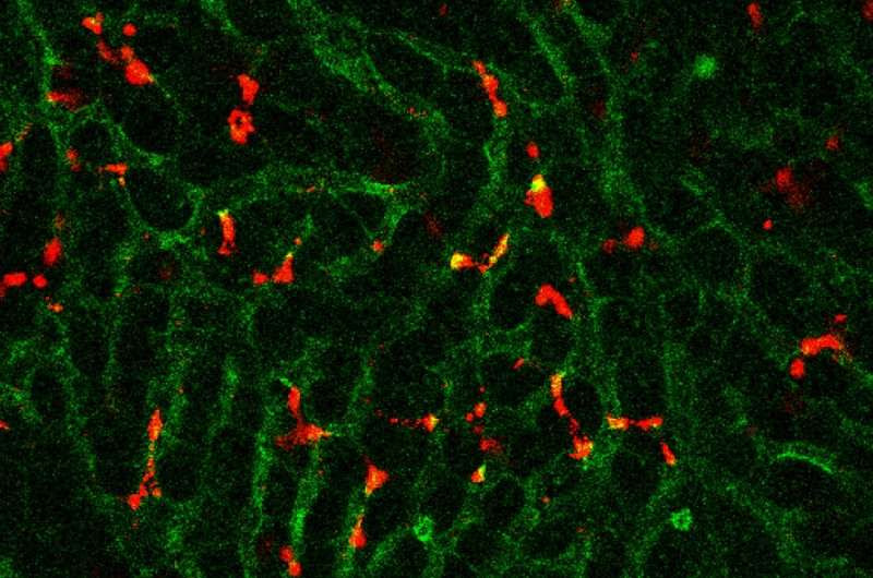 New nano particles suppress resistance to cancer immunotherapy