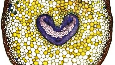 Cross Section Though Leaf of Cheilanthes lanosa