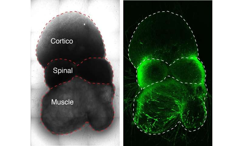 Scientists assemble human nerve circuit driving voluntary movement