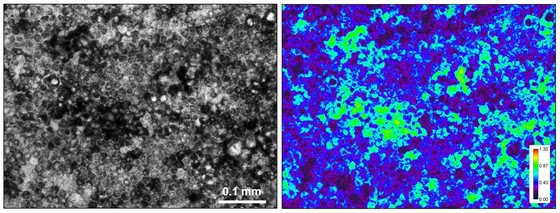 Two images of cells, one is black and white and the other is blue and green.