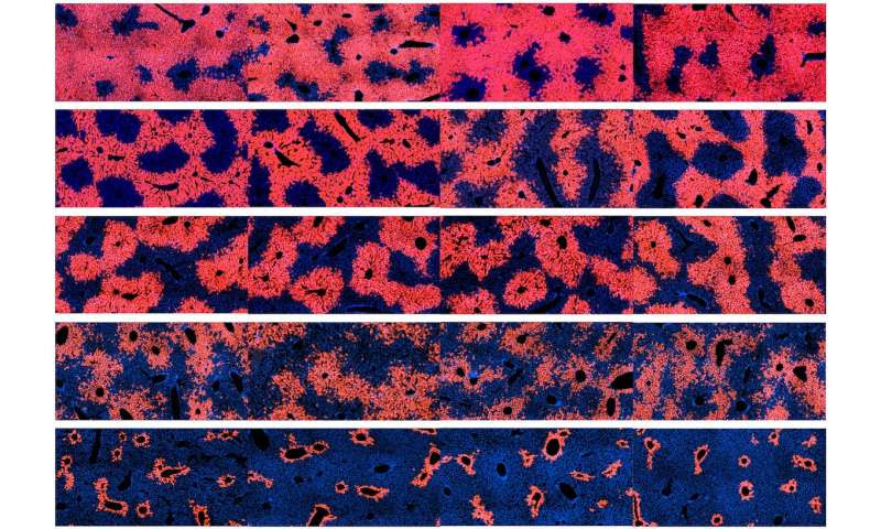 Scientists identify cells responsible for liver tissue maintenance and regeneration