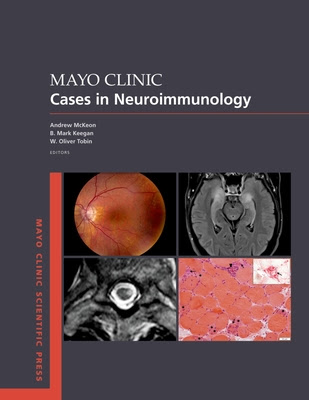 Mayo Clinic Cases in Neuroimmunology PDF