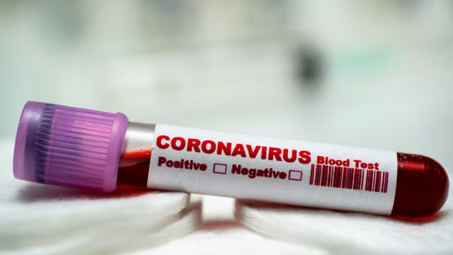 Brasil tem 59 mortes por coronavírus e 2.554 casos confirmados