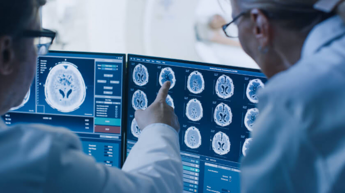 MRI scan for traumatic brain injury case