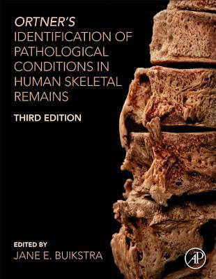 Ortner's Identification of Pathological Conditions in Human Skeletal Remains EPUB