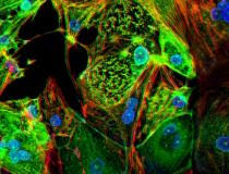 Um estudo da Escola de Medicina da Universidade de Washington em St. Louis fornece evidências de que o coronavírus pode invadir e se replicar dentro das células do músculo cardíaco, causando morte celular e interferindo na contração do músculo cardíaco.  A imagem do tecido cardíaco modificado mostra células do músculo cardíaco humano (vermelhas) infectadas com COVID-19 (SARS-CoV-2) (verde).  Consulte Mais informação.  Imagem de Lina Greenberg.