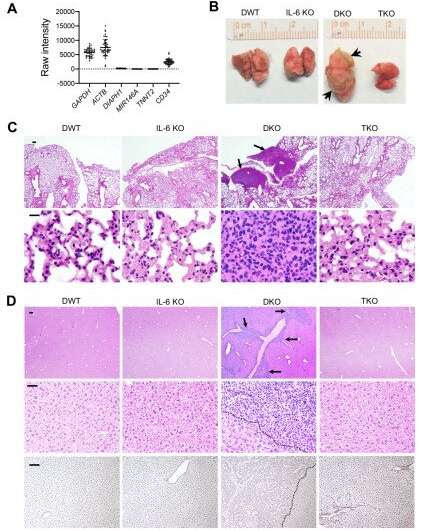 Inflammatory signaling linked to leukemia progression