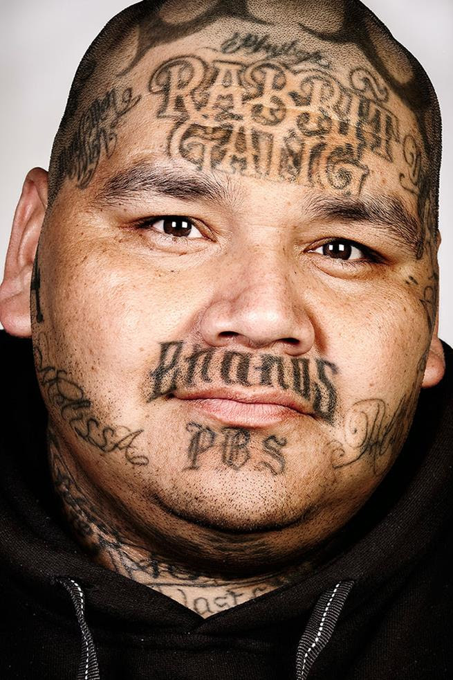 tatuage_removida_05