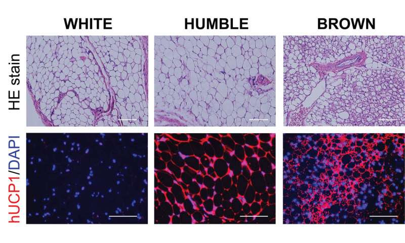 Transplanted brown-fat-like cells hold promise for obesity and diabetes