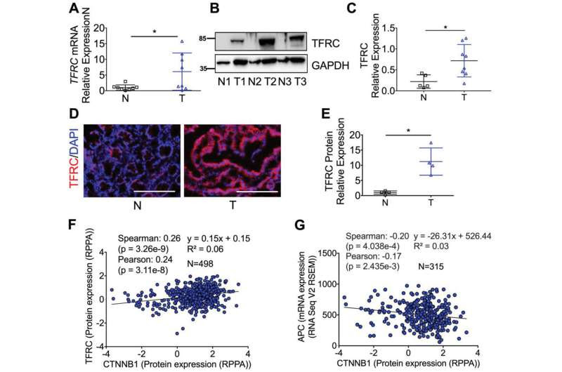 Colorectal cancer research: Scientists describe how iron helps drive tumor development