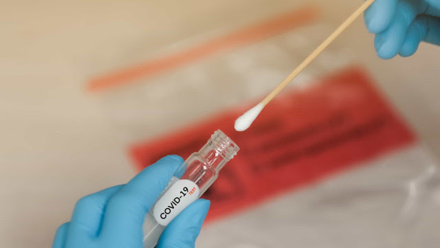 Testes de Covid positivos em farmácia alcançam menor patamar na pandemia