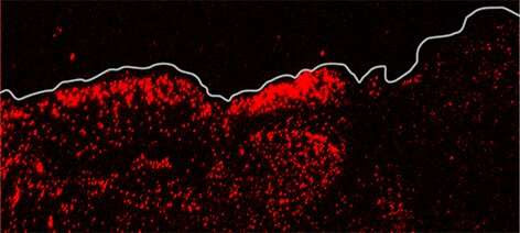 UCI researchers reveal critical role of mechanosensor in skin wound healing