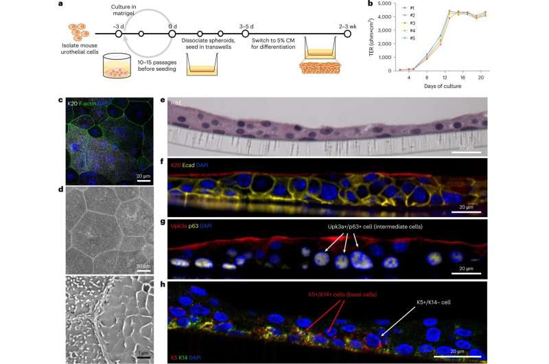 Hidden epigenetic mechanisms behind chronic UTIs found