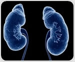 Scientists explore popular pre-heart transplant therapy’s impact on kidney function