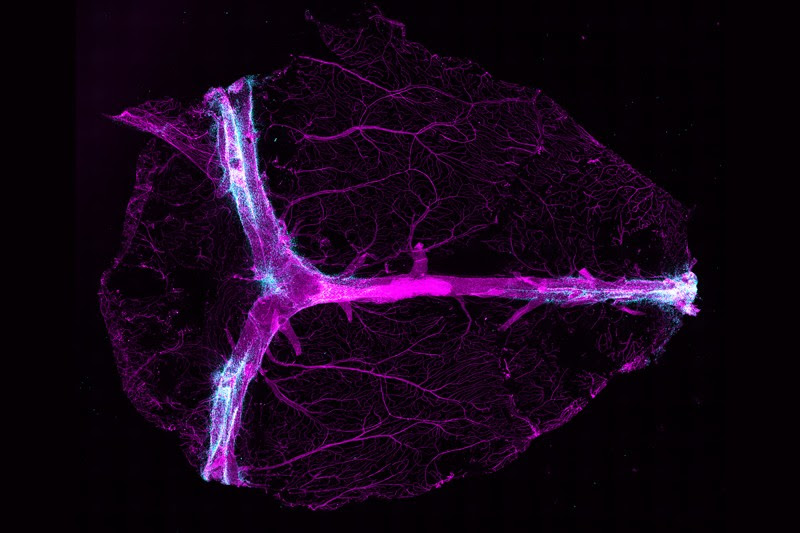 Micrograph of a whole mouse brain showing blood vessels and dural sinuses in magenta and cerebrospinal fluid in teal